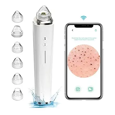 Blackhead Remover Pore Vacuum, Upgraded WIFI Visible Facial Pore Cleanser with HD Camera Pimple 