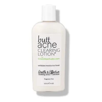 Butt Acne Clearing Lotion for Body, Vegan & Cruelty Free