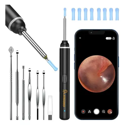 VITCOCO Ear Wax Removal Kit Ear Camera 1920P HD Ear Wax Removal Tool Ear Cleaner Otoscope with L