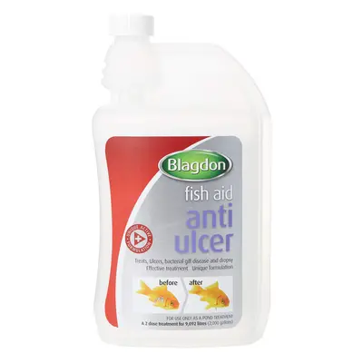 Blagdon Anti-Ulcer Treatment for Pond Fish, Effective, Unique Formulation, Treats Ulcers, Bacter