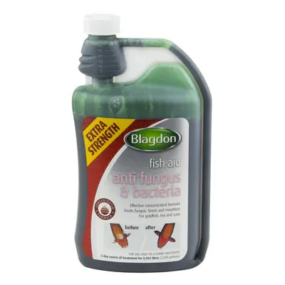 Blagdon Extra Strength Concentrated Formula Anti Fungus & Bacteria Water Treatment for Pond Fish