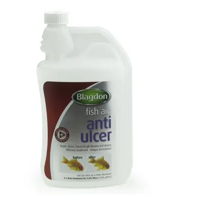 (1000ml) Blagdon Anti Ulcer Fish Treatment