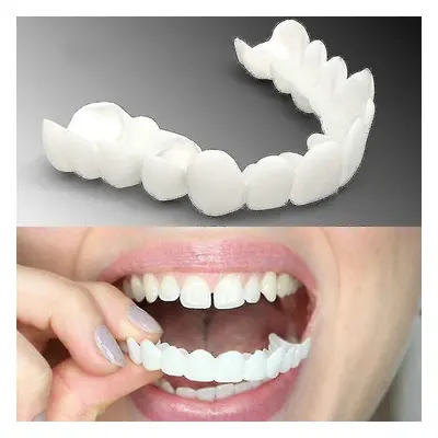 Set Perfect Smile Teeth Veneers Top And Bottom Fake Cosmetic Teeth Veneers Instant Comfort Fit W