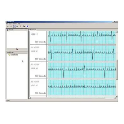 Omron HCG-801 Heartscan ECG Software Extension Pack (no monitor)