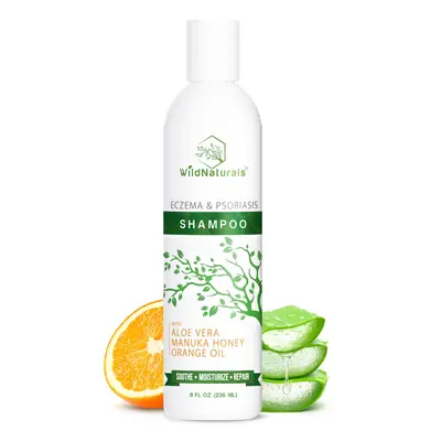 Psoriasis Shampoo for Dry Scalp Care Anti Dandruff Gentle Hydrating Shampoo for Itchy Scalp Trea