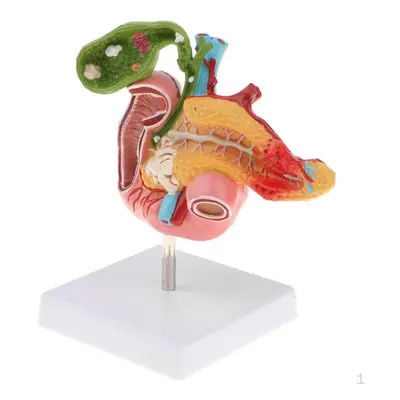 1:1 Human Pancreas Duodenum Gallbladder Model