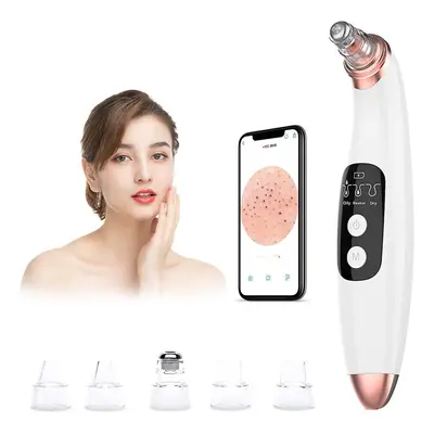 Blackhead Remover Vacuum Pore Cleaner With Camera - Acne Extractor Tool Exfoliat