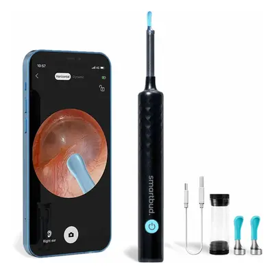 Smartbud Ear Wax Removal Tool with Camera - 1920P Smart Ear Cleaner Earwax Removal Kit - Otoscop