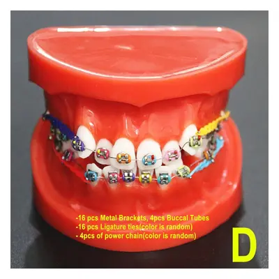 (1 piece D) Piece Transparent Dental Orthodontic Mallocclusion Model With Brackets Archwire Bucc