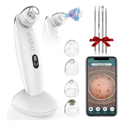 Blackhead Remover Vacuum , 5mp Visible Electric Facial Pore Cleanser Blackhead Suction Tool, Mod