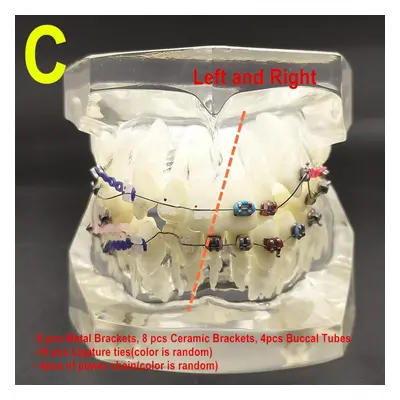 (1 piece C) Piece Transparent Dental Orthodontic Mallocclusion Model With Brackets Archwire Bucc