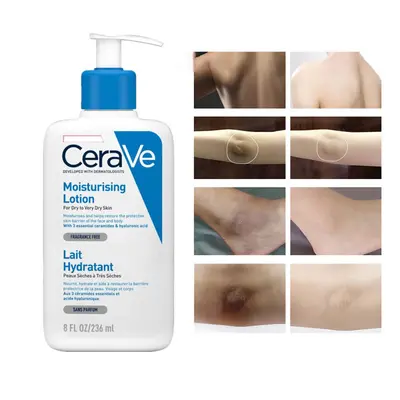 CeraVe Whitening Cream Moisturizing Nourish Repair Improve Arm Armpit Ankles Elbow Knee Body Dul