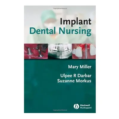 Implant Dental Nursing