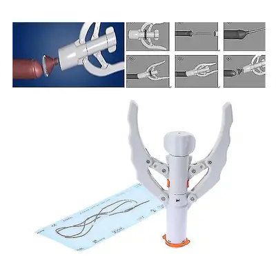 Disposable Circumcision Stapler Circumcision Genital Surgery Instrument With Rubber Ring