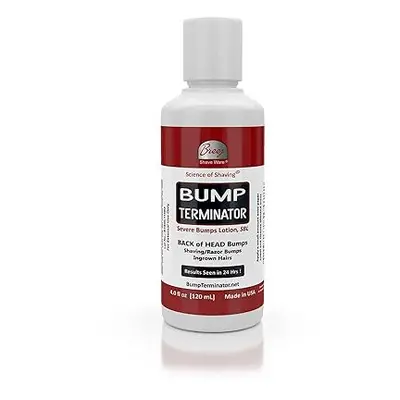 Bump Terminator Severe Bumps Lotion (4oz)