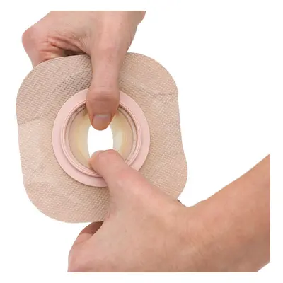 New Image FormaFlex Moldable Extended Wear Ostomy Barrier Adhesive Ta