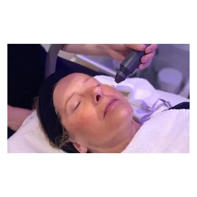 Cryotherapy luxury facial with algae facemask; new customers only