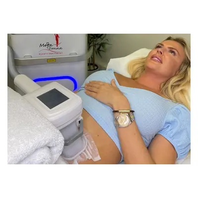 Two areas, cryogenic lipolysis; must be 18 or older