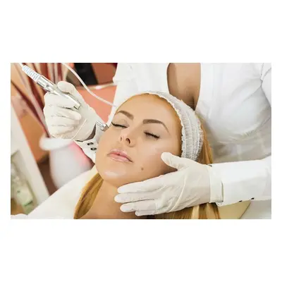 One 30-minute microdermabrasion session