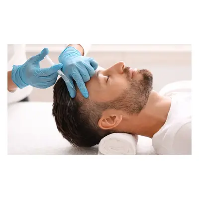 Two sessions of platelet-rich plasma hair treatment