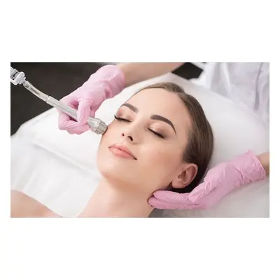 One Microdermabrasion Treatment