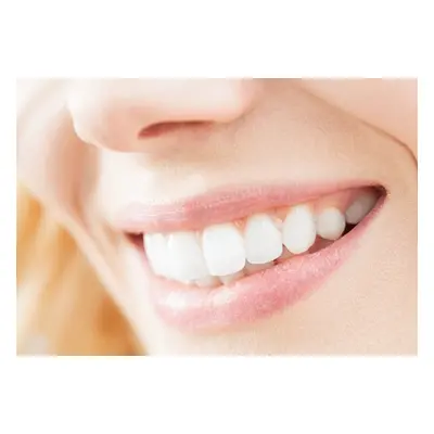 One Laser Teeth Whitening Treatment