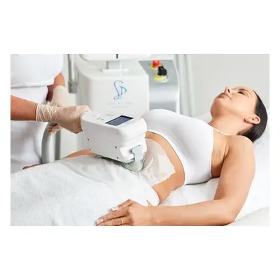 Four Areas of Fat Freezing (Cryolipolysis) 1 x Treatment