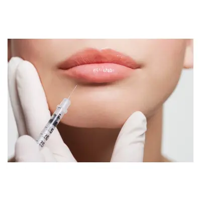 1ml Lip Filler