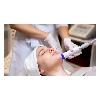 Microdermabrasion & LED Therapy (NEW CUSTOMER)