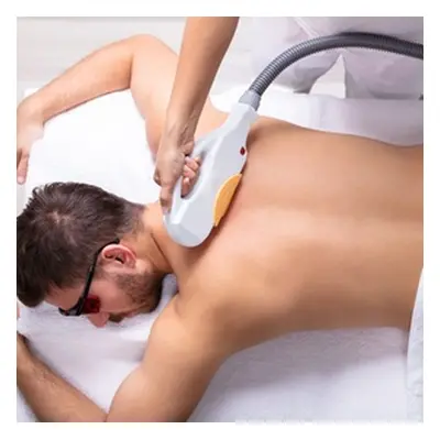 Male Full Back Laser Hair Removal 6 sessions