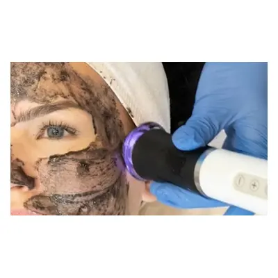 OxyGeneo 3 in 1 Oxygen Facial