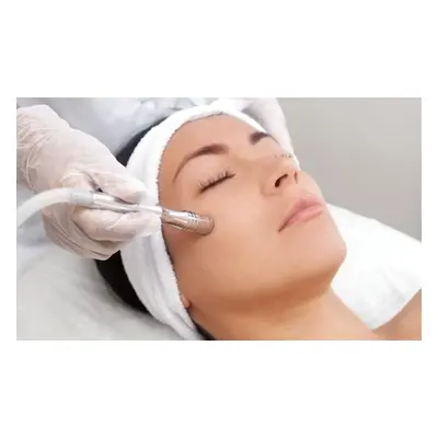 3 Diamond Facial Peel Treatment