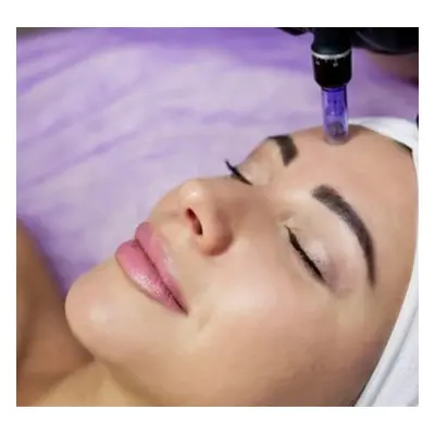 Microneedling Facial