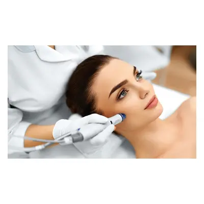 Two sessions of microdermabrasion