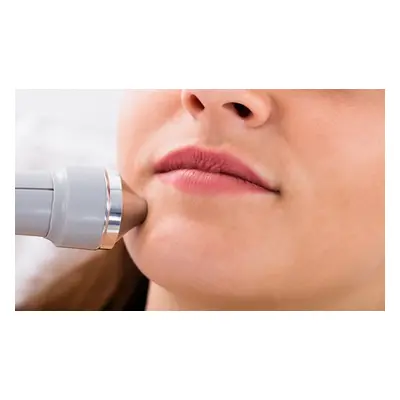 Three dermio oxygen facials