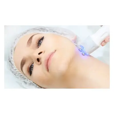 One session of HIFU double chin reduction