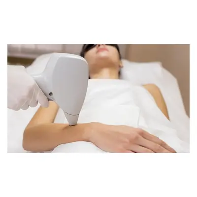 Full body area, six sessions of IPL laser hair removal