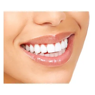 Laser teeth whitening and examination