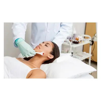 One Session of Microneedling Mesotherapy Facial With Botulium Effect