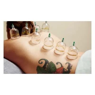 Mobile service massage or cupping therapy