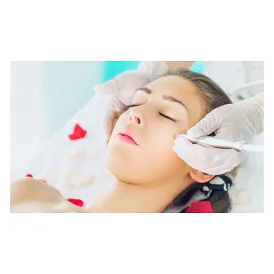 One session of microdermabrasion