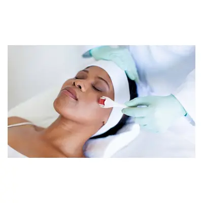 Micro Needling Treatment with customized serum Dermplane or chemical Peel and LED Light Therapy 