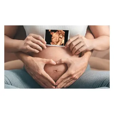 3D,4D Baby Ultrasound Scan with DVD Two Prints and a USB of all Images