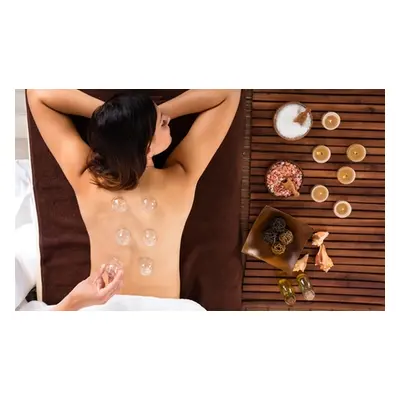 45-minute acupuncture and cupping session