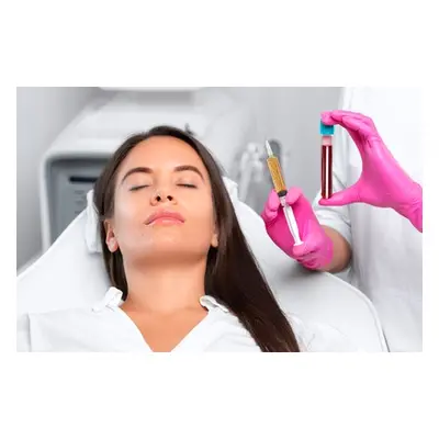 1 Session of Vampire Face Lifting - (PRP) Platelet-Rich Plasma