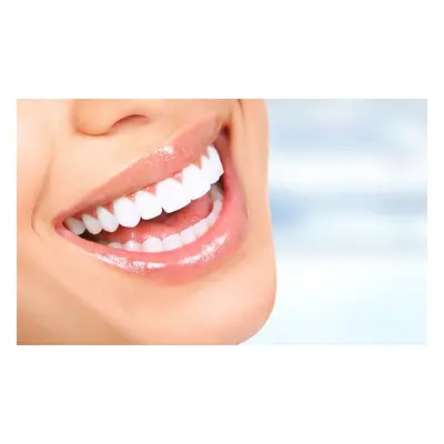 Teeth whitening with a dental check-up scale and polish valid Monday-Friday