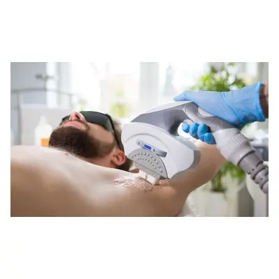 Laser Hair Removal for Men - BACK & SHOULDERS x 4 sessions