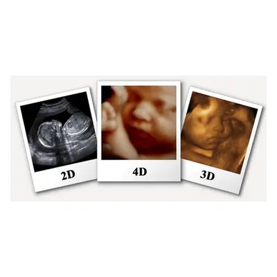 Gender ultrasound scan with 2 picture