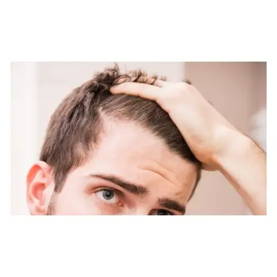 One session of PRP Hairloss treatments