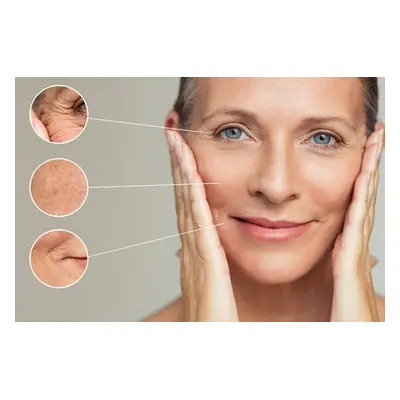 Three Radio-Frequency Skin-Tightening Treatments